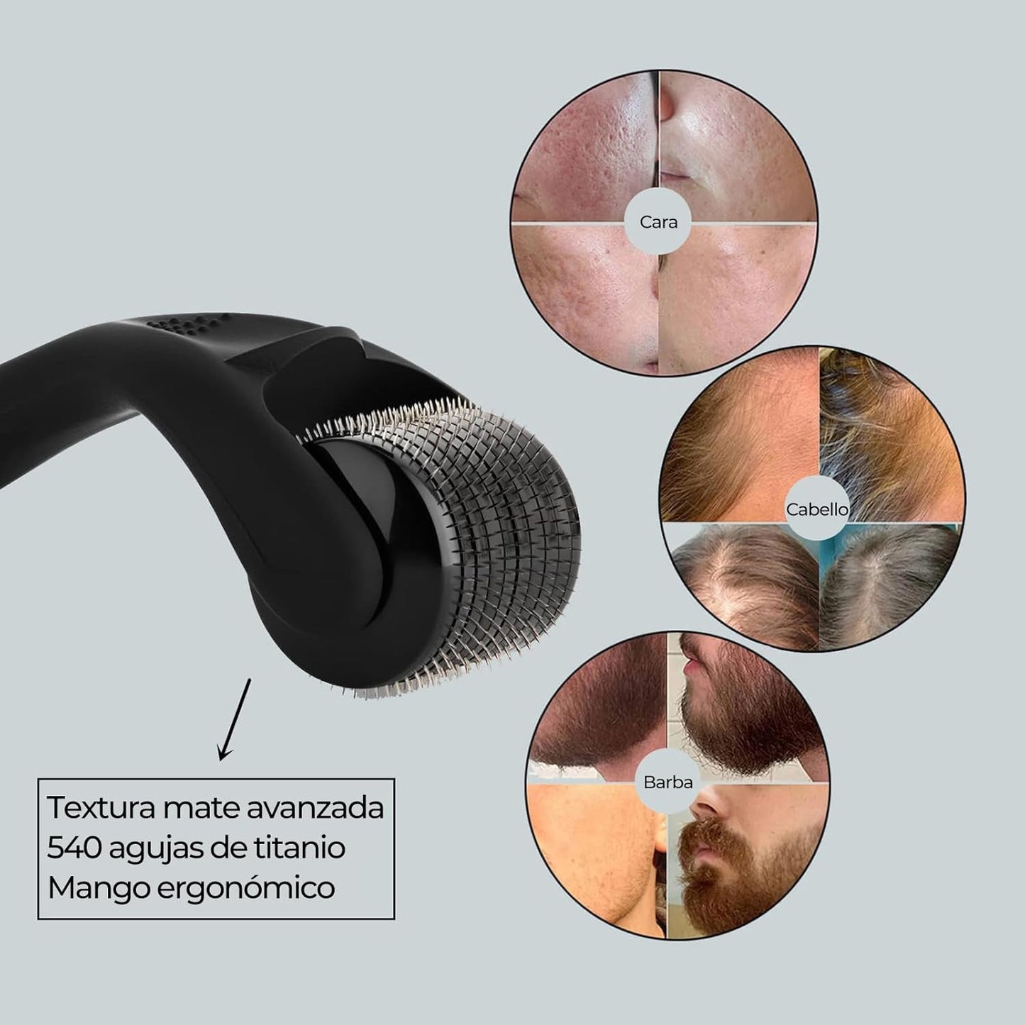 Derma Roller para crescimento capilar
